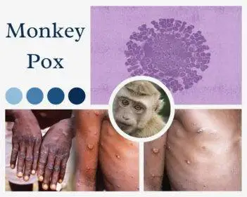 what is monkey pox virus