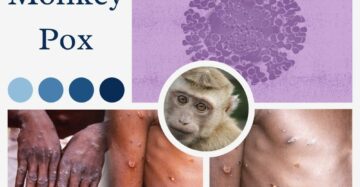 what is monkey pox virus
